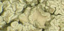 Lecanora sinuosa